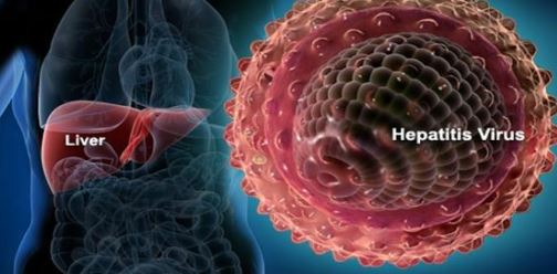20220514 Ilustrasi Hepatitis Akut